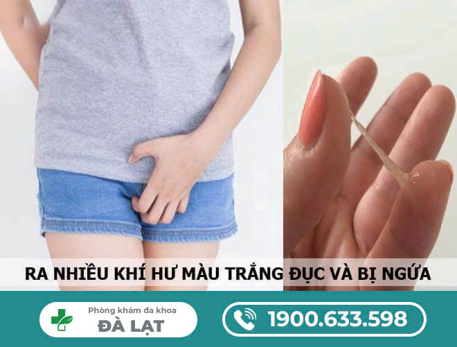 Hình ảnh minh họa